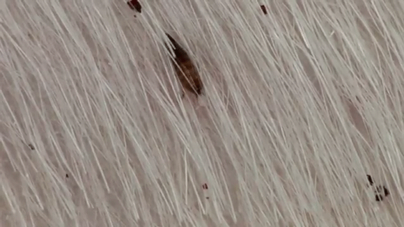 flea eggs on bed sheets